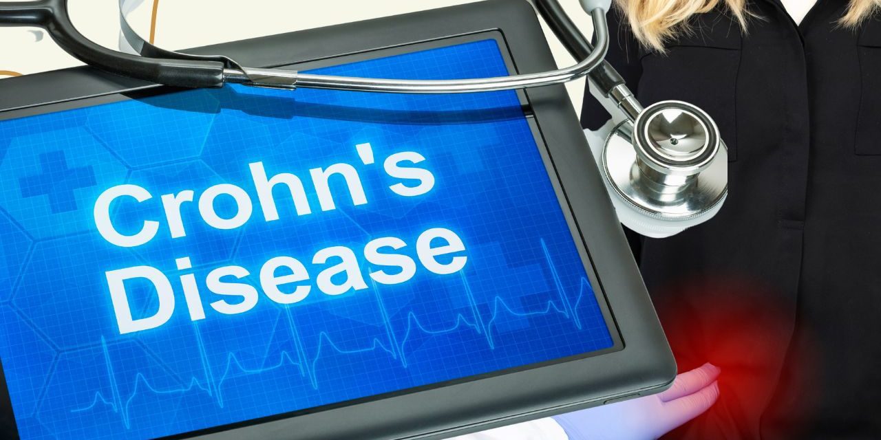 Understanding and Treating Crohn’s Disease