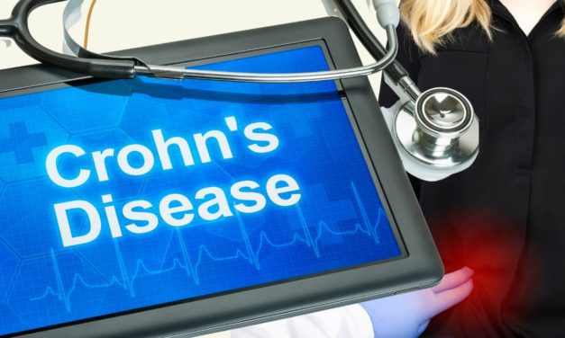 Understanding and Treating Crohn’s Disease