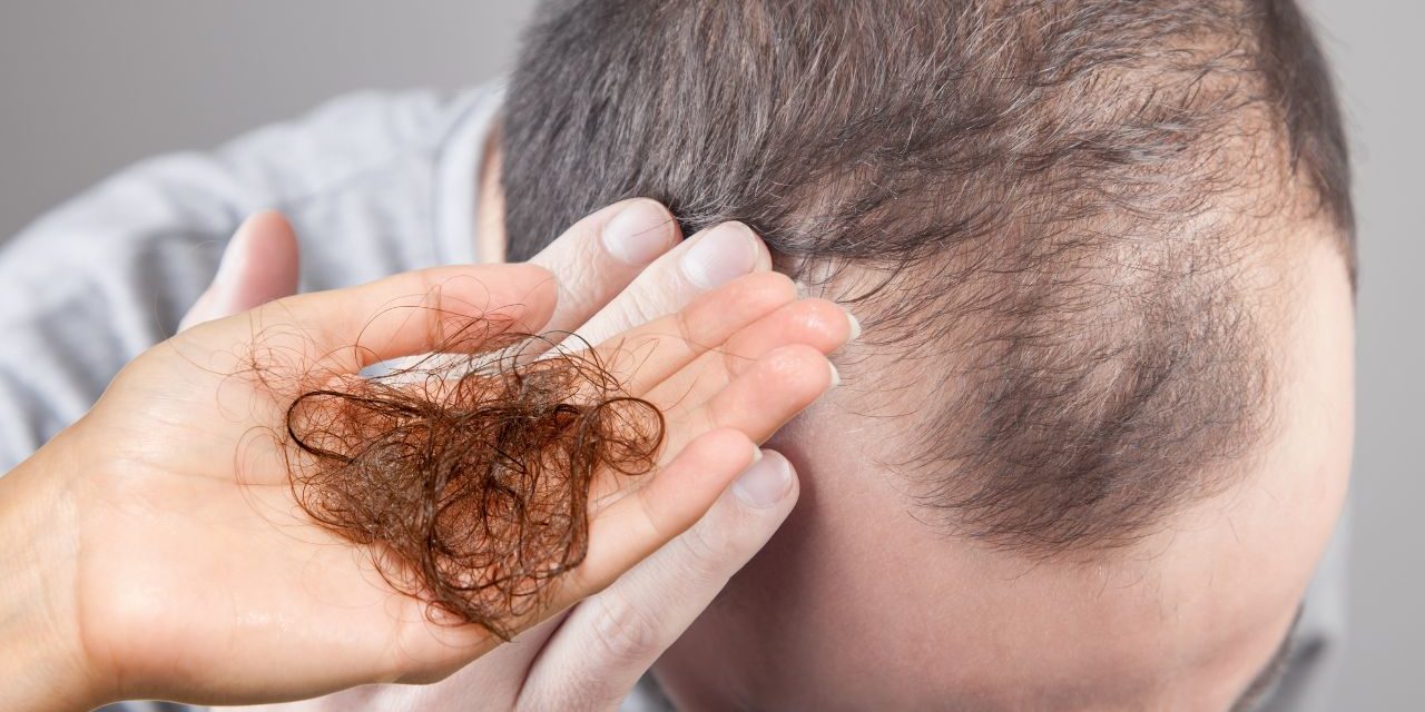 Hair Loss: Let Us Tell You About Hair Loss Disease and Treatment