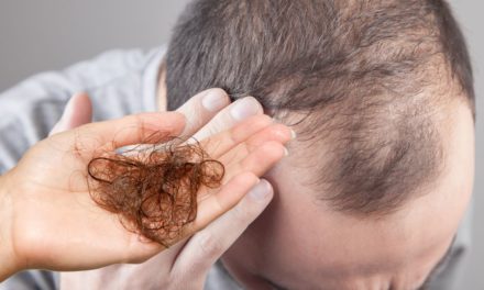 Hair Loss: Let Us Tell You About Hair Loss Disease and Treatment