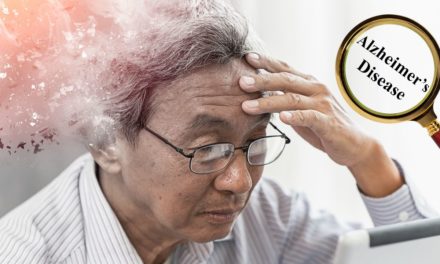 Alzheimer’s Disease and Best Treatment