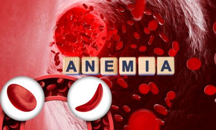 Anemia Disease and Best Treatment