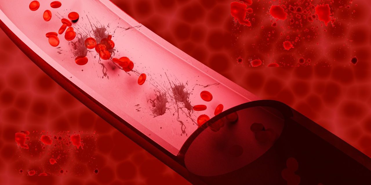 Blood Impurities Disease and Best Treatment