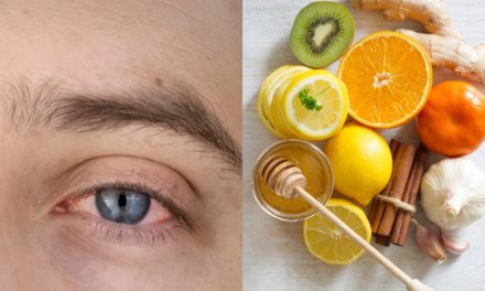 Eye Flu Prevention: Home Remedies That Can Prevent Eye Flu