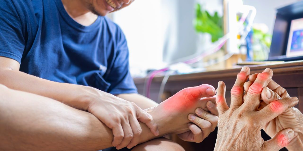 Gout: Let Us Tell You About Gout Disease and Treatment