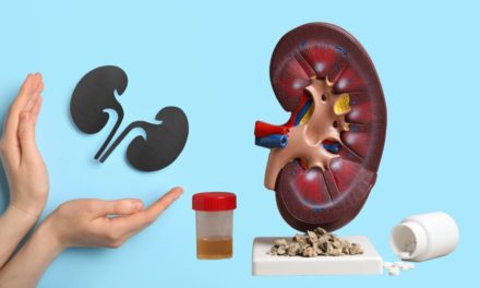 Kidney Stone Disease and Best Treatment