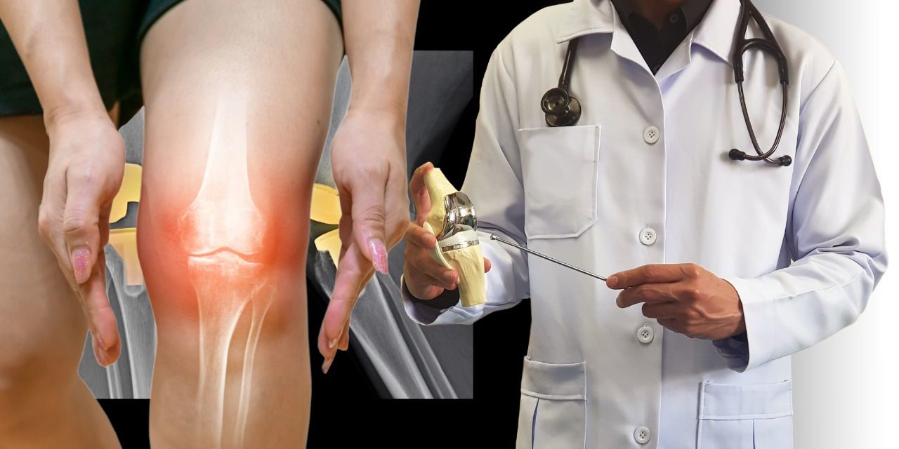 Osteoarthritis: Let Us Tell You About Osteoarthritis Disease and Treatment
