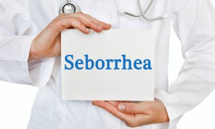 Seborrhea Disease and Best Treatment