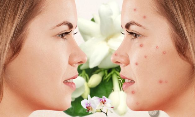 TRIED AND TESTED REMEDIES FOR CLEAR AND PIMPLE-FREE SKIN.