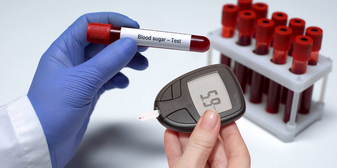 UNMASKING THE INFORMER SIGNS: RECOGNIZING HIGH BLOOD SUGAR SYMPTOMS.